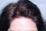 Female Hair example 2 after
